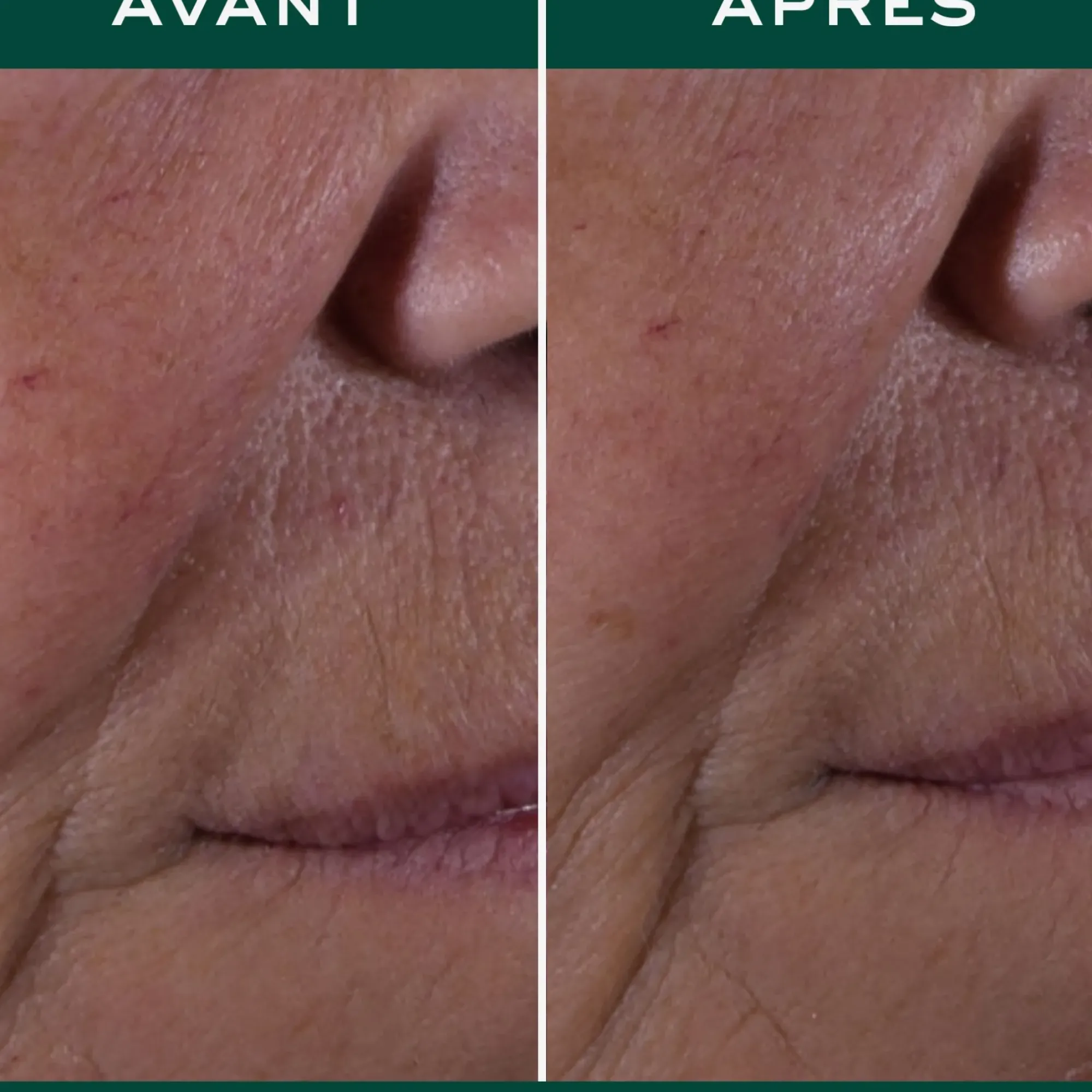 NUXE La Crème Anti-Âge Global New