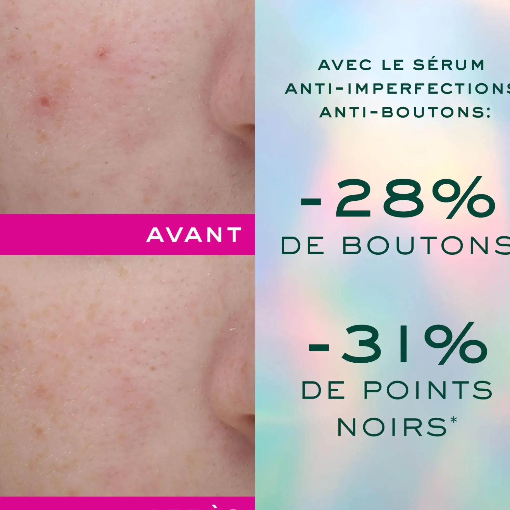 NUXE Sérum anti-imperfections anti-boutons Best Sale