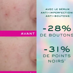 NUXE Sérum anti-imperfections anti-boutons - Trousse offerte Online